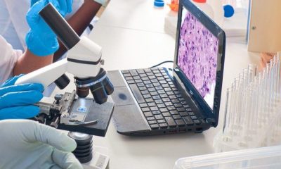 A laptop and microscope in a lab with researchers just out of shot.